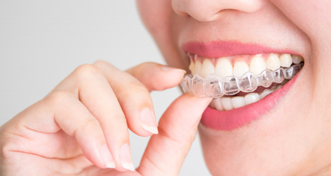 Invisalign/ Orthodontics