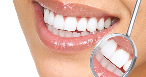 Teeth Whitening